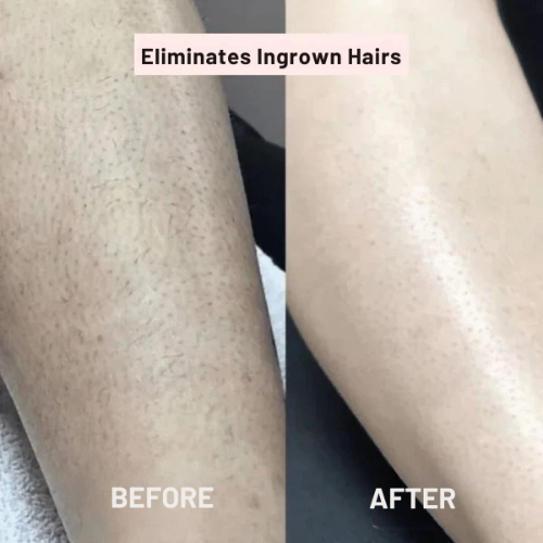Dame barbermaskine – Glat hud uden irritation